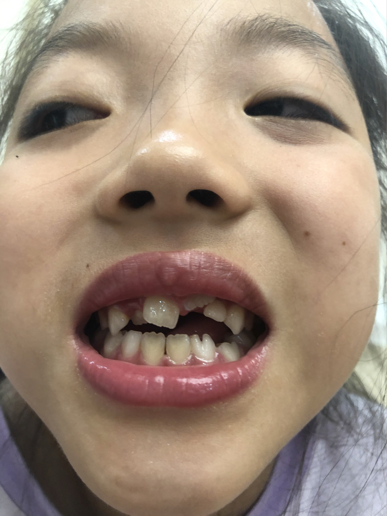 莊最新牙齒技術(shù)揭秘，牙齒美容新選擇